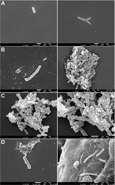 Старое соединение из 1950-х годов полностью уничтожило туберкулёз в лёгких мышей за 30 дней